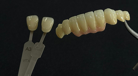 Zerconia-vinayaga dental lab
